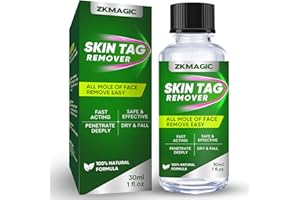 ZKMAGIC Skin Tag Removal, Fast-Acting Wart Remover, Skin Tag Remover Dry & Fall Away Quickly, Natural and Safe, Suitable for All Skin Types