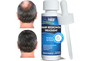 GELPRETTY 60ml Sérum Anti Chute Cheveux,Stimule la Pousse et Réduit la Chute, Formule Légère pour Cheveux Plus Épais et Résistants, pour Hommes et Femmes