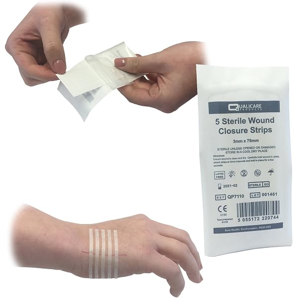 String Wounds Small Steri-strip Alternatives Conkote Wound Closure Strips - 40 Breathable ...