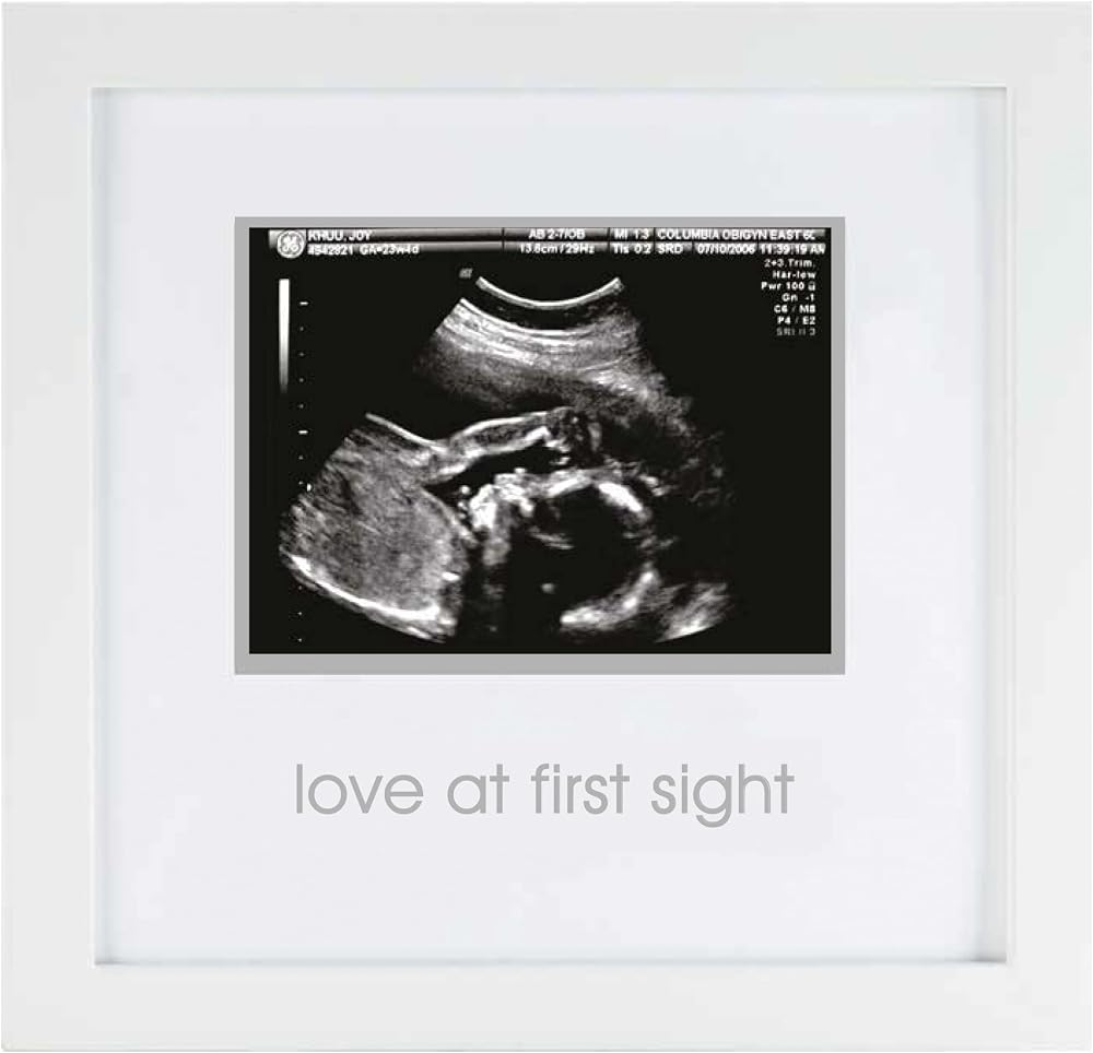Pearhead İlk Görüşte Aşk Sonogram Resim Çerçevesi, Hamilelik Hatırası Fotoğraf Çerçevesi, Cinsiyetsiz Bebek Odası Dekoru, Anneler Günü Aksesuarı, Beyaz