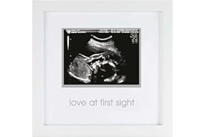 Pearhead Love at First Sight Sonogram Picture Frame, Gender Neutral Ultrasound Keepsake, Ideal Pregnancy Gift, Baby Shower and Nursery Decor, White