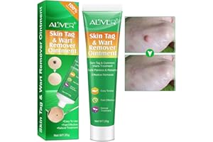ZOXPM Skin Tag Remover Warts & Mole Remover Cream (20G Cream)