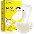 Hydrocolloid Acne Patch(20 Patches), Large Spot Control Cover With Long Size, Extra Larger Acne Pimple Patch for Covering Large Breakouts, Spot Patch, Stickers for Body, Cheek, Forehead, and Chin