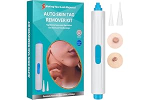 FLETUTE Skin Tag Removal Kit - Gentle CryoTag Device, Painless at-Home Solution, Safe Skin Tag Remover & Tag Buddy System