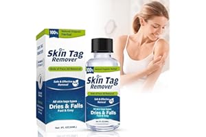 WERPOWER Skin-Tag-Removal-Kit-Skin-Tag-Remover, 30ML Wart& Mole-Remover Liquid, Fast-Acting and Effect, Blue