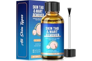 BOXMOM Wart Remover,Fast-Acting Skin Tag & Wart Remover for Feet & Hands,Skin Tag Removal Kit Effective Treatment for Plantar and Common Warts,Flat Warts,Corns,and Calluses Natural & Safe (30ML)