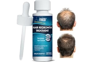 OKALABANDEE 60ML Sérum Croissance des Cheveux, Stimule la Pousse, Soin Cheveux, Pour Adulte Clairsemés