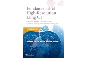 Fundamentals of High-Resolution Lung CT: Common Findings, Common Patterns, Common Diseases and Differential Diagnosis