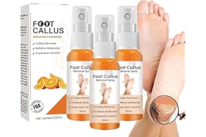 K.KIECHEL GFOUK Foot Callus Removal Spray,30ml Foot Heel Callus Remover Spray,Foot Callus Softener Spray,Foot Peel Spray,Foot Exfoliating Spray - for Quickly Remove Dead Skin and Calluses On Feet (3pcs)