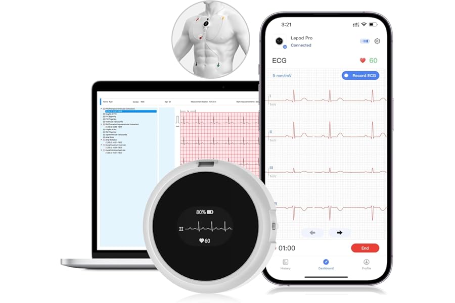 CheckMe LepodPro 7-Lead ECG Monitor with OLED Display, 24-Hour Real-Time ECG Recording, Detailed AI ECG Reports, Event Markers, 72-Hour Battery Life, Smartphone APP & PC Support for Home Use