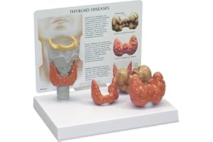 3B Scientific Thyroid Model