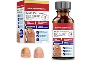 LURELUXE 30ml Endurecedor y Reparador de Uñas, Reparadores de Uñas Solución, Cuidado uñas, Fortalece la estructura de la uña, Ayuda a Mejorar su Apariencia y Brillo Natural