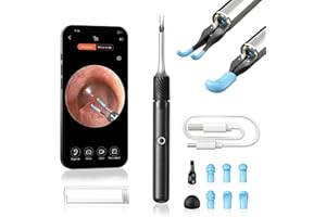 Qimic Ear Wax Removal with Tweezers - 1080P HD Cleaner Camera Omni-Direction Ear Pick Tweezer, Real-Time Remote Video, Multi Earwax Cleaning Replacement Kits