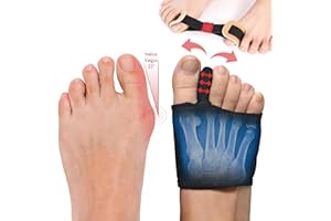 LureLuxe 1 Paar Hallux Valgus Korrektur Hallux Valgus Socken und 1 Stück Hallux Valgus Zehenspreizer Trainingsband für den Zeh,Hammerzeh Korrektur und Schutz,Hallux Valgus Korrektur Schiene für den