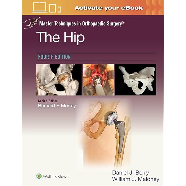 Buy Master Techniques in Orthopaedic Surgery: Fractures Book