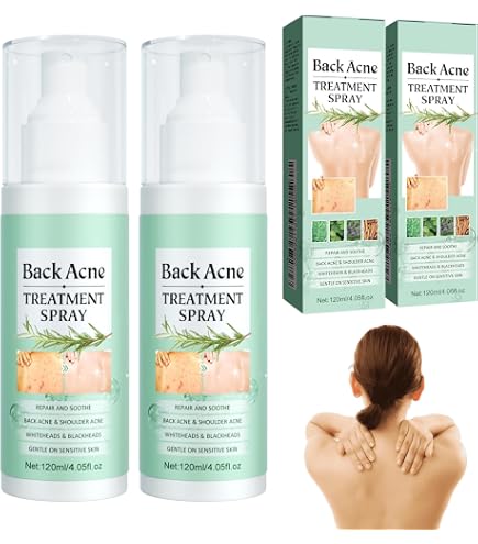 Lot De 3 Crèmes Anti-acné Himalaya Clarina 30g - Naturelle - Neuf