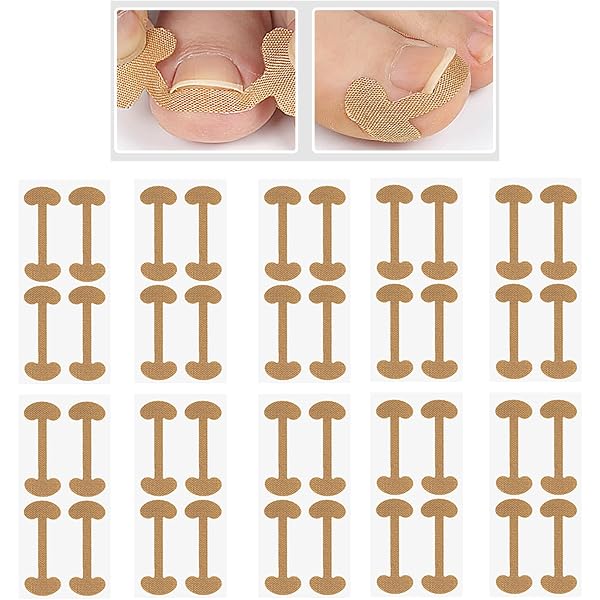 CATOR 50-teiliges Set Gegen Eingewachsene Zehennägel – Mit Korrekturstreifen & Nagelheber – Schmerzfrei