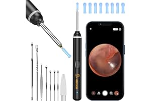 ‎VITCOCO Earwax Remover Otoscope, VITCOCO 1920P Wifi Ear Cleaner, Ear Cleaner with Camera, Otoscope with 6 LEDs for iPhone, iPad and Android Smartphones, Black