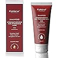 Foltene Shampoo Strengthening For Thining Hair, Men, 6.76oz