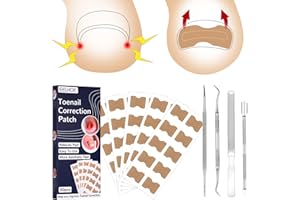 AUXSOUL Zehennagel Korrektur, 50 Stücke Eingewachsene Zehennägel mit 4 Pediküre-Werkzeugen, Toenail Correction Patch, Ingrown Toenail Stick Patch, Korrektor Pediküre Werkzeugen