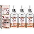 Speedy Milia Remover,Milia Remover,Dark spot remover,Organic Skin Spot Purifying Serum,Helps Dissolve and Reduce Milia,Facial Treatments for Eyelid Milia,Acne,Blemish,Pimple,Whitehead,Cysts