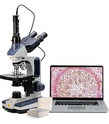 AmScope T490B-DKO – Trinokulares Dunkelfeld-Verbundmikroskop, 40X–2000X, Mit Ölkondensator, Parfokaler Photoanschluss – Für Klinische Labore