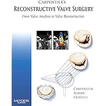 Buy Carpentier's Reconstructive Valve Surgery Book Online at Low