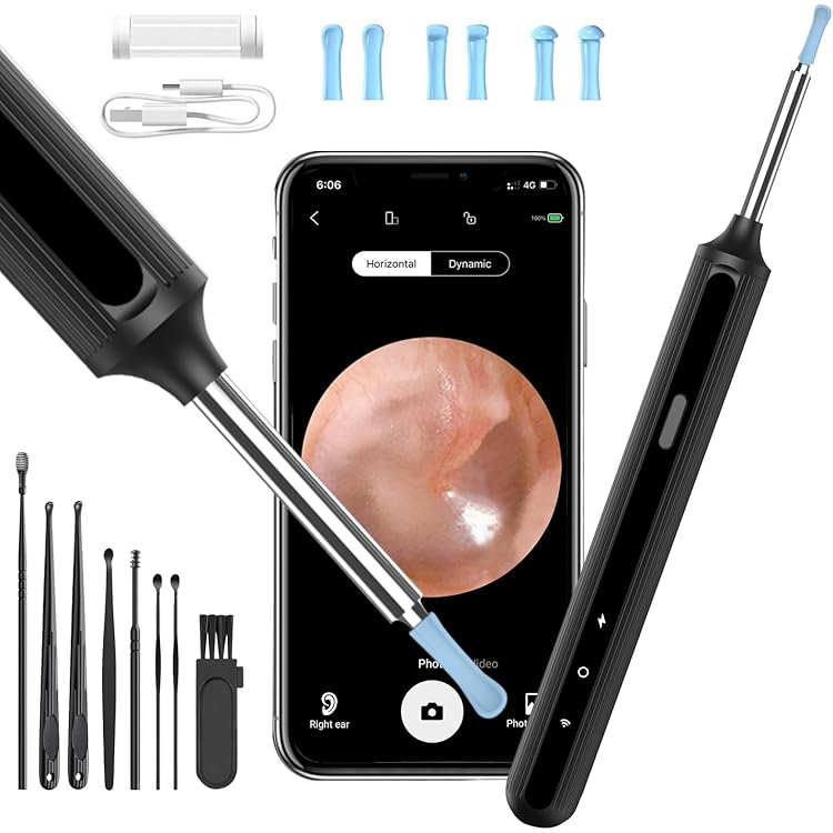 1920P Otoskop PKBD Ohrreiniger Mit 1920 HD Kamera - Ohrenschmalz Entferner Mit App Für Android & IOS 1920P HD Ohrkamera