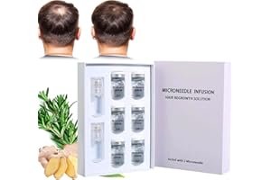 WBIETU AlphaInfuse Système de repousse des cheveux, Alpha Infuse, solution de repousse des cheveux, technologie de micro-infusion indolore pour la croissance des cheveux, repousse rapide, rend les cheveux
