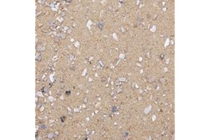 Dihl 5KG Aviary Bird Cage Sand with Oystershell, Calcium & Minerals Aids Digestive Health and General Well Being. Premium Quality for all Birds, 5 KG