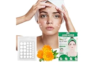 MEGIAEXIST Pimple Patches, 300 Stück Hydrocolloid Anti Pickel Patches Unsichtbare Acne Patch mit Salicylsäure & Teebaumöl & Centella Asiatica 2-in-1 Tag & Nacht Pickel Pflaster Patches für Gesicht 4 Größen