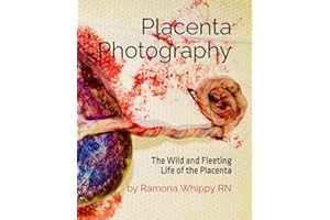 Placenta Photography: The Wild and Fleeting Life of the Placenta