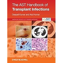 The AST Handbook of Transplant Infections [ペーパーバック] Kumar Amazon | The AST Handbook of Transplant Infections | Kumar