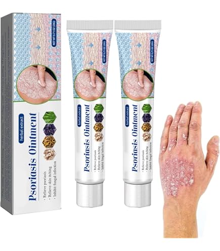 Crème 15g Pour Psoriasis Et Dermatite - à Base De Plantes, Hydratante, Corps Et Visage