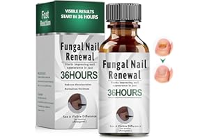 HALERCAY 30ml Gotas para Cuidado De Uñas De los Pies,Reparadores de Uñas Solución,Calmar y Nutrir Las uñas,cuidado Diaria y Mejora Aspecto,Para Dañadas Y Descoloridas