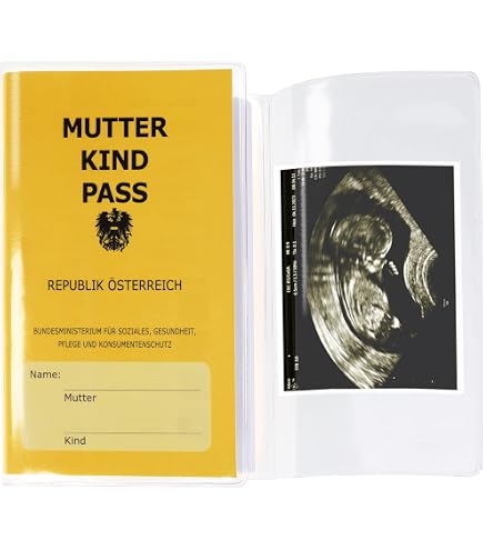 Protège Carnet De Santé Bébé En Feutre - 4 Poches Intérieures, Carte Vitale, Pochette Ordonnance Avec 2 Porte-clés - Caramel