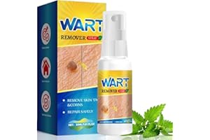 RUOJIAR Verruca and Wart Remover,Wart Freeze Spray,Verucca Freeze Treatment for Effective Wart and Verucca Removal,Wart Remover Fast Acting and Painless,Face Mole Remover,Warts Removal Freeze for All Type