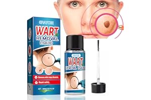 ERAYCEE Skin Tag Removal Kit, Wart Removal Liquid 30ML, Frozen Skin Tag Remover, Natural Removal Without Leaving Traces, Skin Renewal Without Irritation, Suitable for All Kinds of People (Blue)