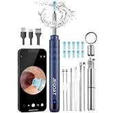 JEGOAT Kulak balmumu temizleme aracı kamera, kameralı kulak temizleyici, kulak temizleme kiti 1296P HD kulak kapsamı, 6 LED ı