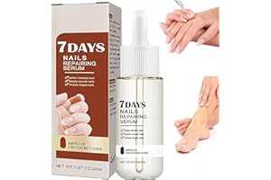 LAMVPINY Sérum de croissance et de renforcement des ongles 7 jours, sérum de croissance et de renforcement des ongles, traitement de croissance des ongles abîmés, ongles plus forts en 1 semaine