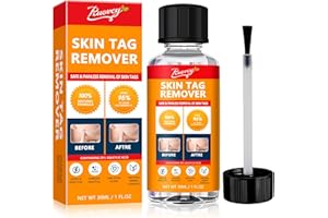 Puovcy Skin Tag Removal Kit - Natural Tea Tree Oil, Suitable for Skin Tags and Warts, Gentle, Effective and Fast Removal of Skin Tags 30ml.