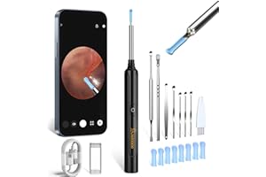 ‎VITCOCO Ohrenschmalz Entferner Otoskop, VITCOCO 5MP HD Ohrenreiniger, Wifi Ohrreiniger Mit 6 LEDs, IP67 Wasserdicht Ohr Reinigung, Ohr Kamera 3,5mm Linse Für iPhone, iPad Und Android-Smartphones (Schwarz)