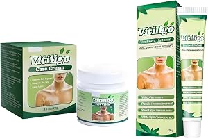 Vitiligo-krämset, tar bort vita fläckar, för vård av vitiligo, hudterapi kräm, förbättrar den reglerande pigmenteringen av vi