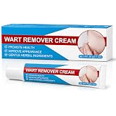 Cream to Remove Warts, Gently Remove Common Warts | Plantar Warts and Calluses, to Eliminate Warts on the Body and Hands, Sui