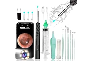 Ohrenschmalz Entferner Otoskop, SPAOTREM Intelligentes Wifi Ohrreiniger, 1296P HD-Otoskop mit kamera, Otoskop mit 6 LEDs, IPX5 Wasserdicht Otoskop Ohr, für iOS, Android (Schwarz)