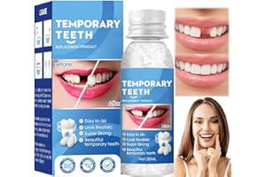 Lomeya Temporary Tooth Filling Kit - Replace Missing Teeth, False Teeth Filler - Easy, Effective Solution