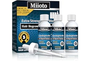 Miioto Serum do porostu włosów, 180 ml, serum na porost włosów, przyspiesza wypadanie włosów, środek na porost włosów, nawilża skórę głowy, szybszy wzrost włosów