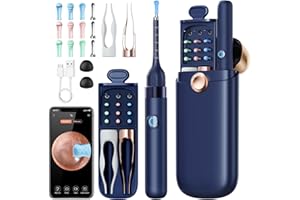 Qimic Ear Wax Removal Tool Camera, Safe Tweezers Wax Cleaner with 12 Ear Scoops, Full ENT Observation Tools for Ear, Nose & Throat, Kids & Adults, Portable with Storage Case