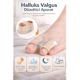 CNGZSHOP Ayak Baş Parmak Kemik Eğriliği D&uuml;zeltici Aparat, Halluks Valgus Silikon Atel, Beige