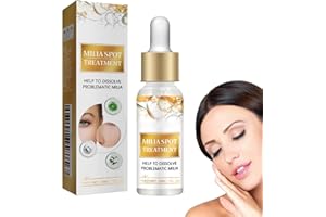 GNAUMORE Milia Removal Spot Care,Milia Treatment under Eye,Milia Remover,Milia Treatment Spot Remover for Face,Milia Spot Reduce Face Serums,30ml